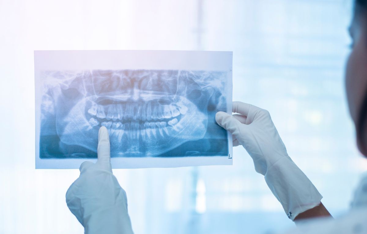 exames-radiologicos-odontologicos-entenda-como-funciona-e-quando-procurar